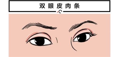 ͺ˫Ƥ޸ҪǮ