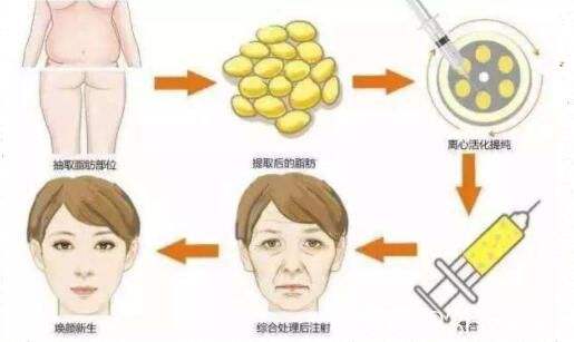 ͺ沿֬Ҫָ೤ʱ