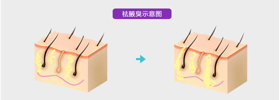 γ