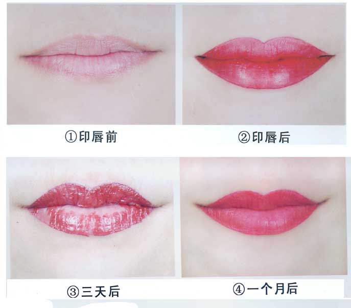 呼和浩特整形