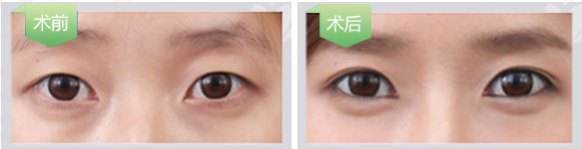 timg (1)
