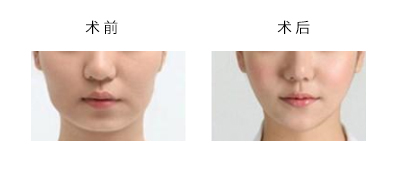 ҽԺ
